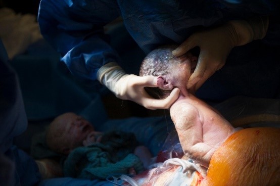 The Impact of Birth Trauma on Breastfeeding: 4 Overlooked Causes
